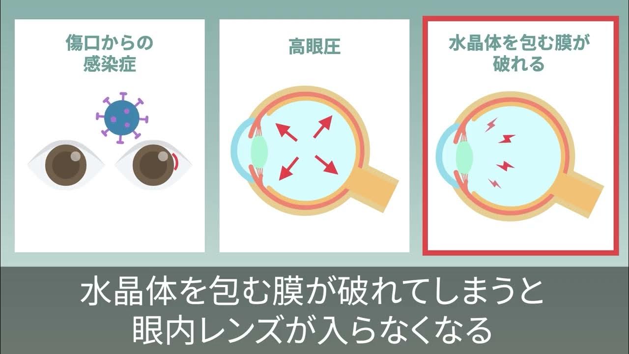 林眼科（サービス紹介アニメーション動画）
